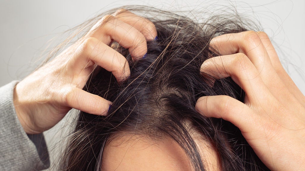 Scalp build up Definition causes and how to get rid of it