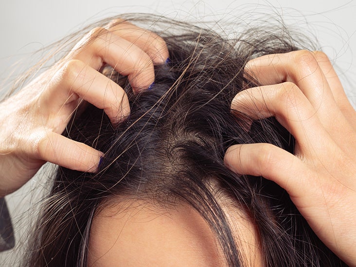 Scalp build up: Definition, causes, and how to get rid of it
