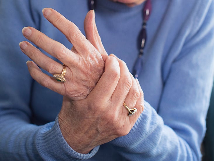 rheumatoid arthritis kar)