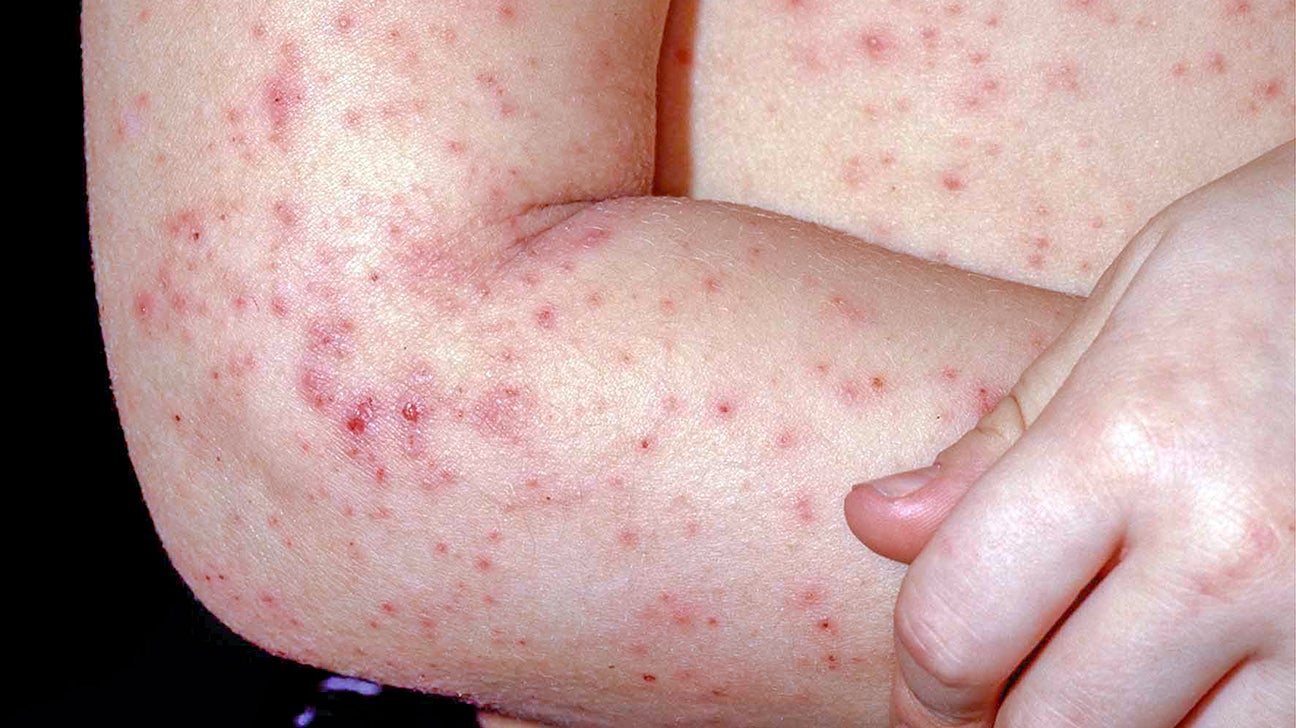 skin diseases on arms
