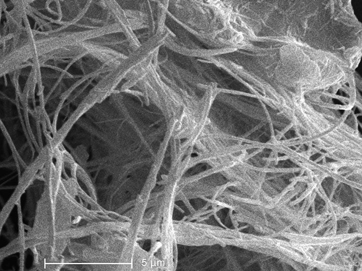 can a ct angiogram detect lung cancer