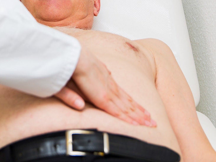 Hepatomegaly Enlarged Liver Symptoms Causes And Treatment