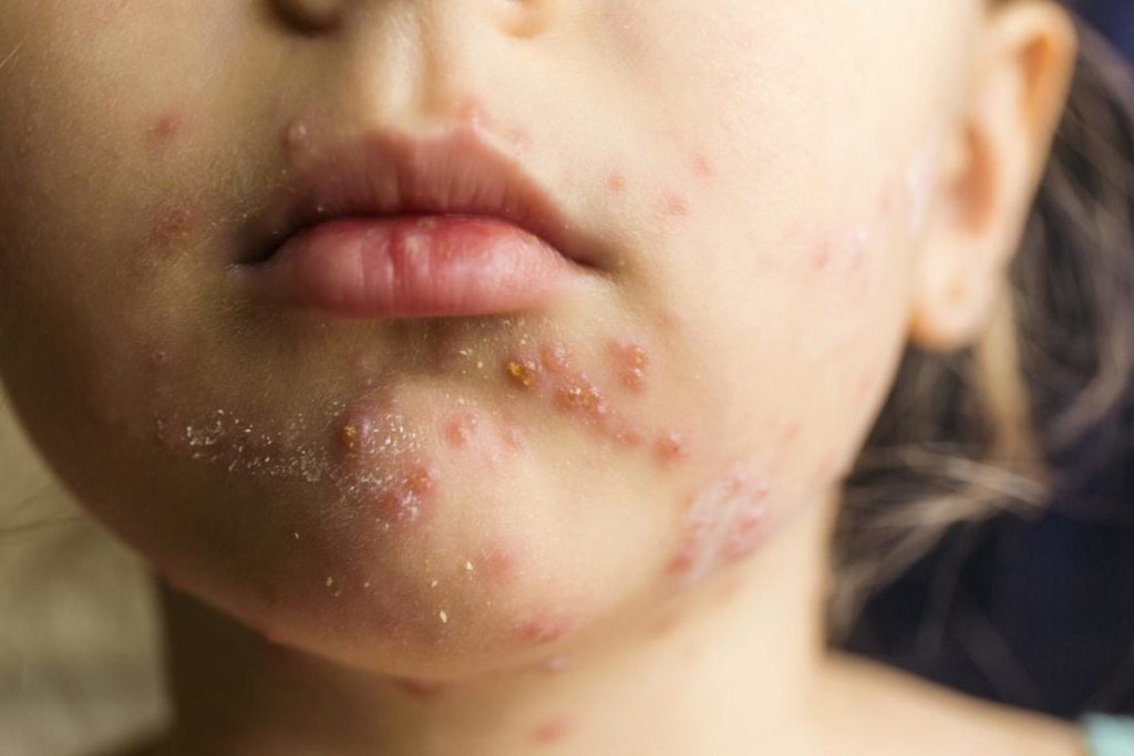 Skin Rash Causes 68 Pictures Of Symptoms And Treatments