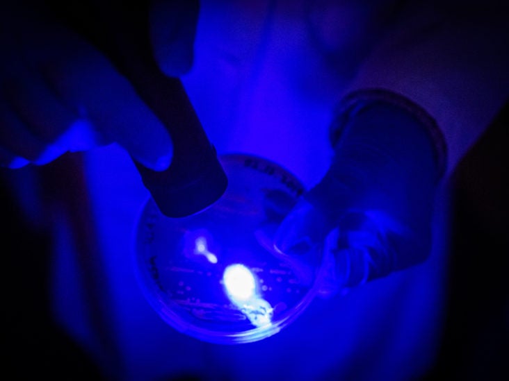 UV light could hospital-acquired infections