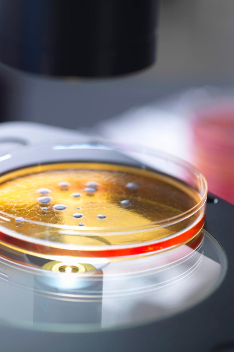 COVID19 Could gut bacteria be involved?