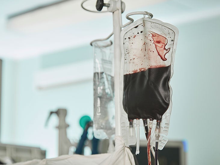 Blood transfusion reaction: Symptoms and treatment