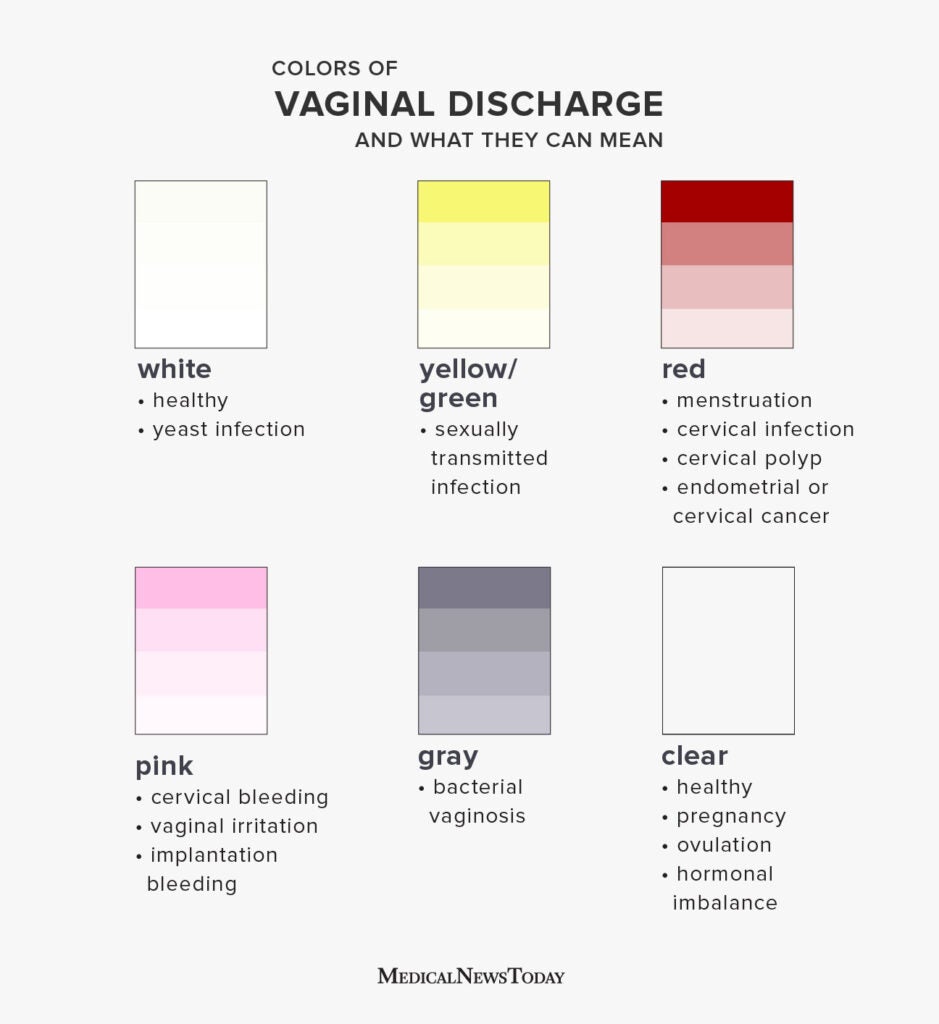 The Many Colours of Vaginal Discharge — When Should You be