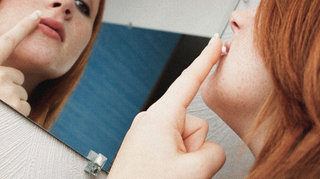 how-to-get-rid-of-a-cold-sore-quickly-treatments-and-remedies