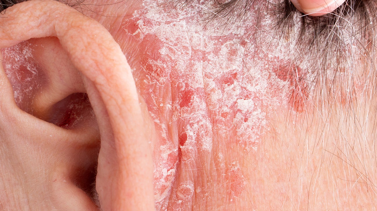Crusty Stuff Behind Ears