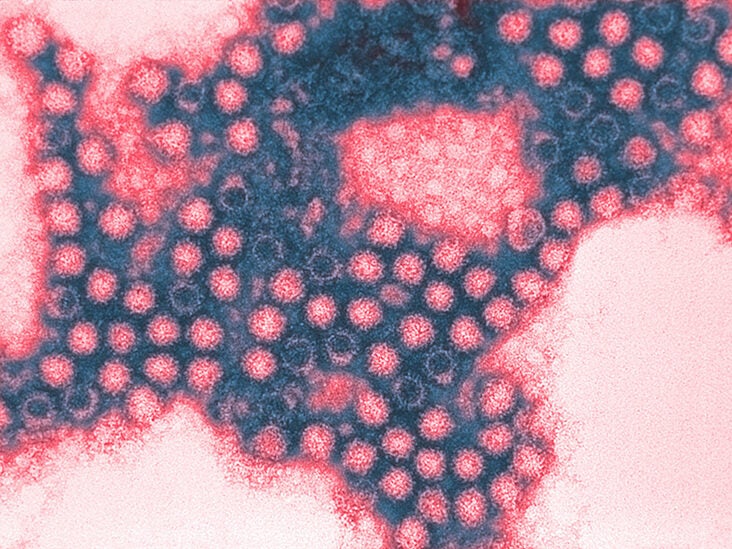 human diseases caused by viruses