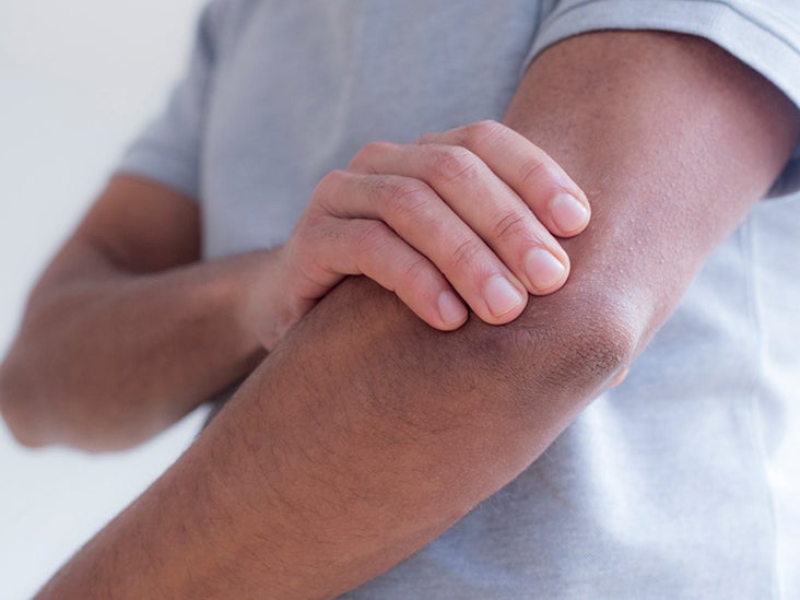 Left arm pain and numbness: When to call 911 and other causes