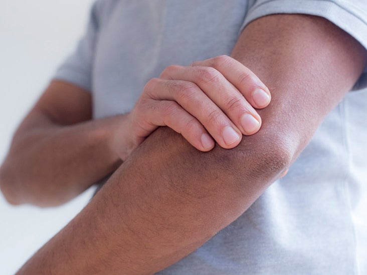 Left arm pain and numbness When to call 911 and other causes Medical