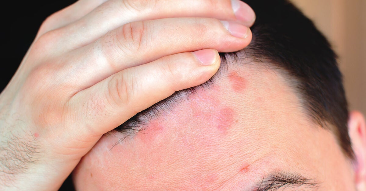 Red spots on scalp: Pictures, causes, and treatments