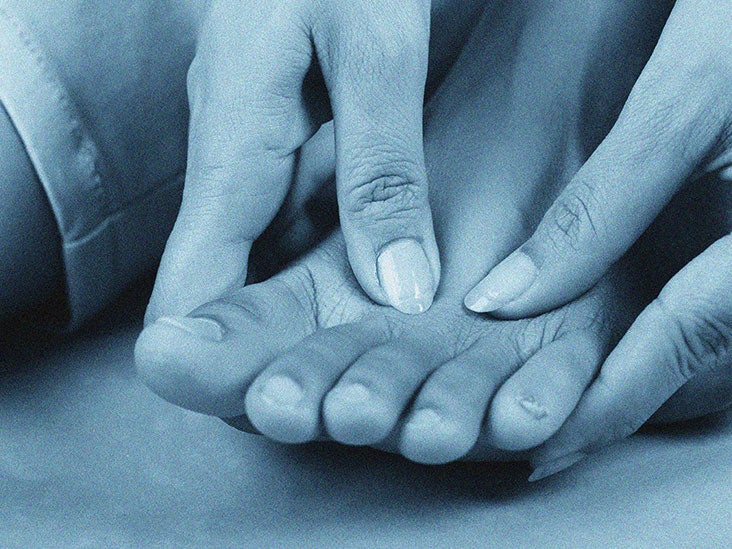 Blue toe syndrome Causes, treatment, outlook, and prevention