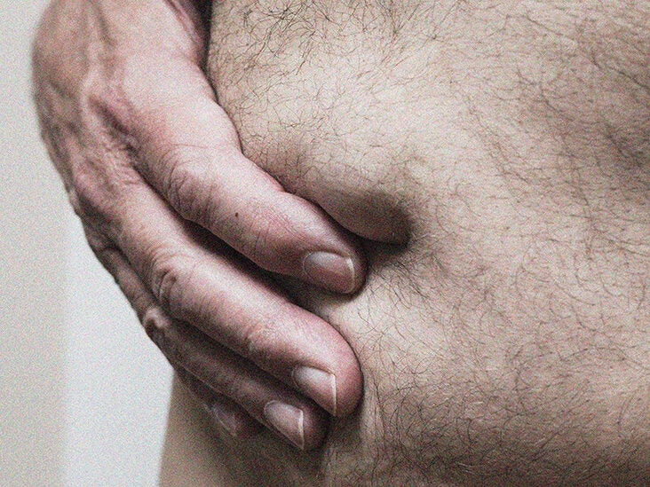 Abdominal cancer belly button - Piercing în buric - Wikipedia