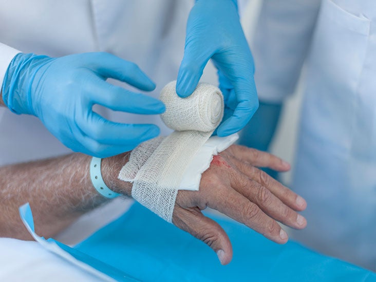 Does Medicare cover wound supplies?