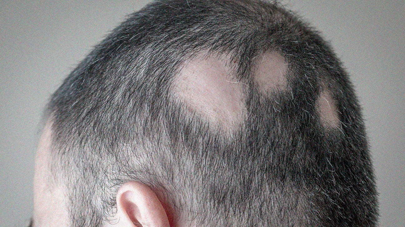 Scalp conditions: Examples, treatment, and pictures
