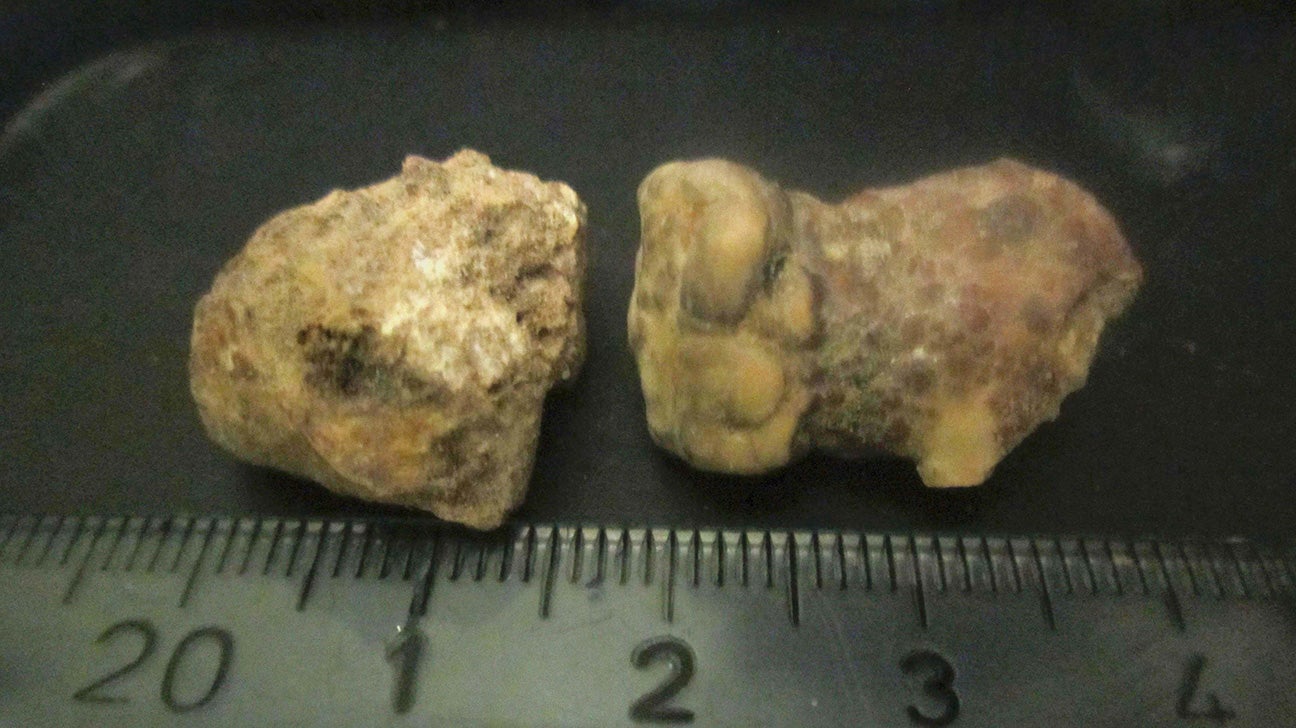 Qishda kochada yalangoch ayollar