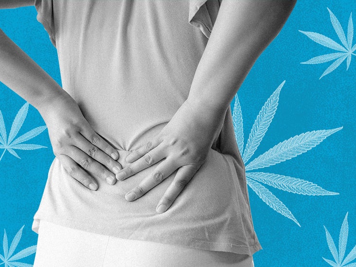 3 of the top CBD creams for back pain