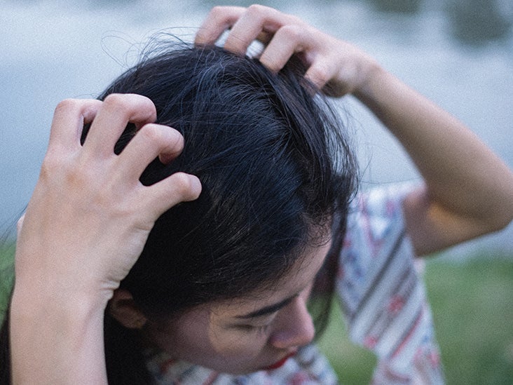 Itchy Scalp: Causes, Symptoms, And Treatment