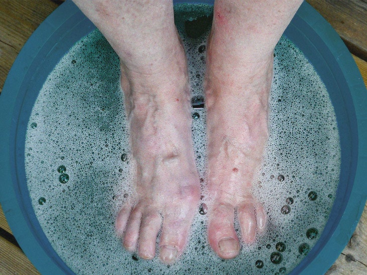 How long can you submerge your foot in ice water 6 Diy Foot Soaks For Dry Skin Pain Relaxation And More