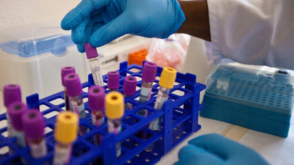 HIV Medication for COVID19 Under Medication