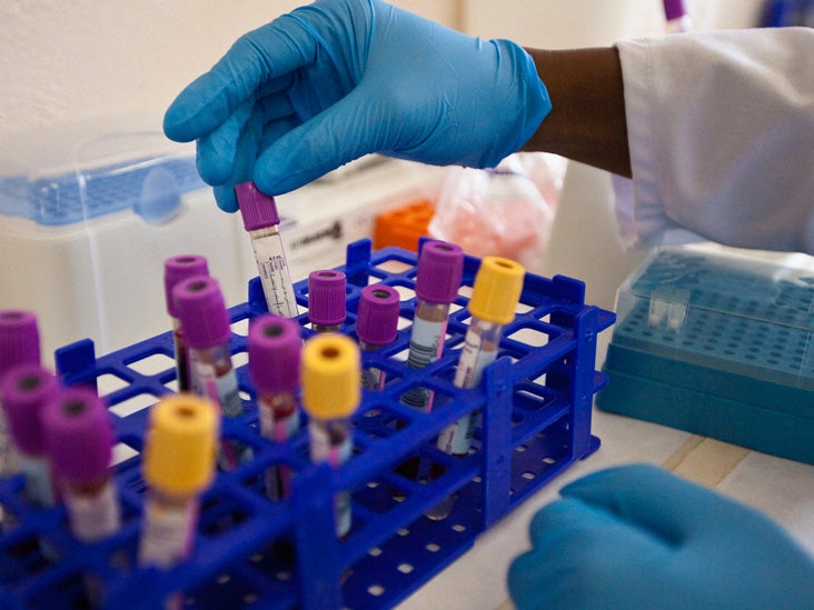 HIV complications Types, symptoms, and staying healthy