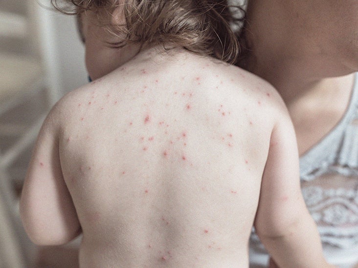 Many causes of red dots on the... 