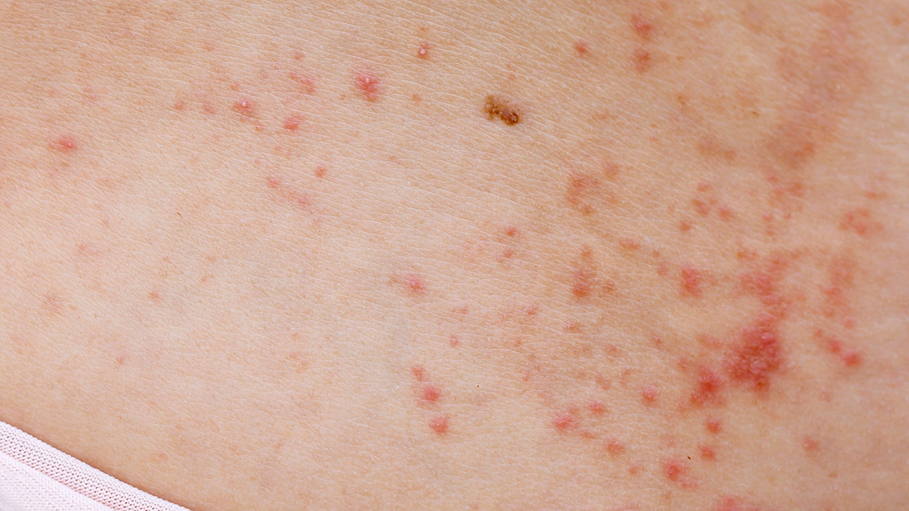 dots on skin: Pictures, causes, treatment, and when seek help