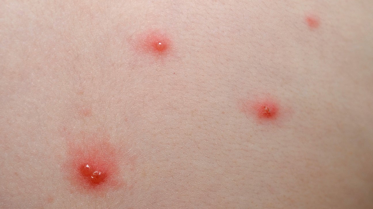 dots on skin: Pictures, causes, treatment, and when seek help
