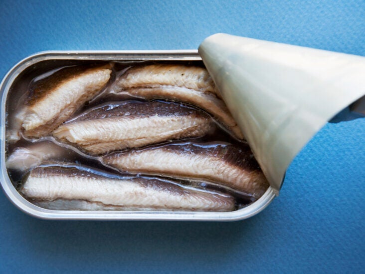 Are sardines good for you? Nutritional benefits and more