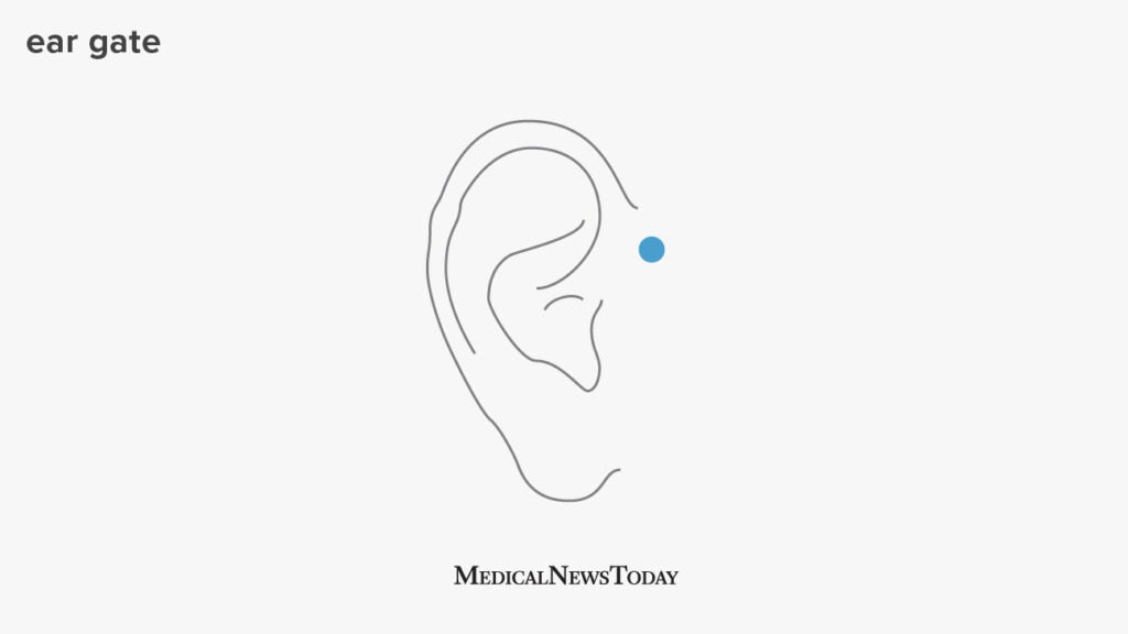 Ear pressure points for migraine relief, tinnitus, and more