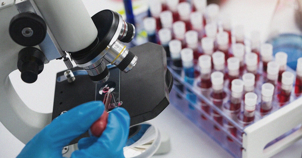 Medicare and thyroid tests Coverage, options, therapies, and costs