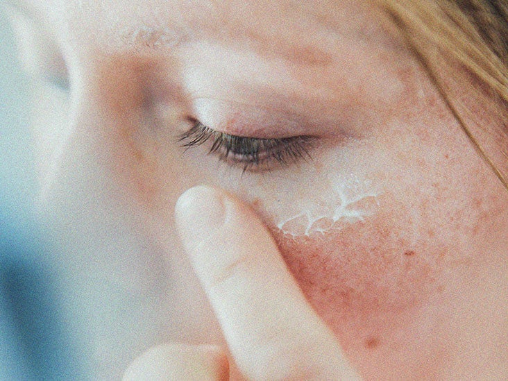 White Chicken Skin Like Bumps Under The Eyes Causes And Treatments