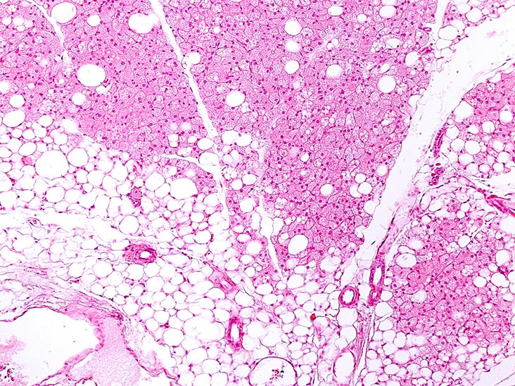 Scientists reveal link between brown fat and health benefits