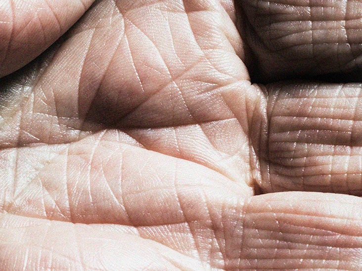 Being male, having overweight and depression can influence aging - Vimarsana News