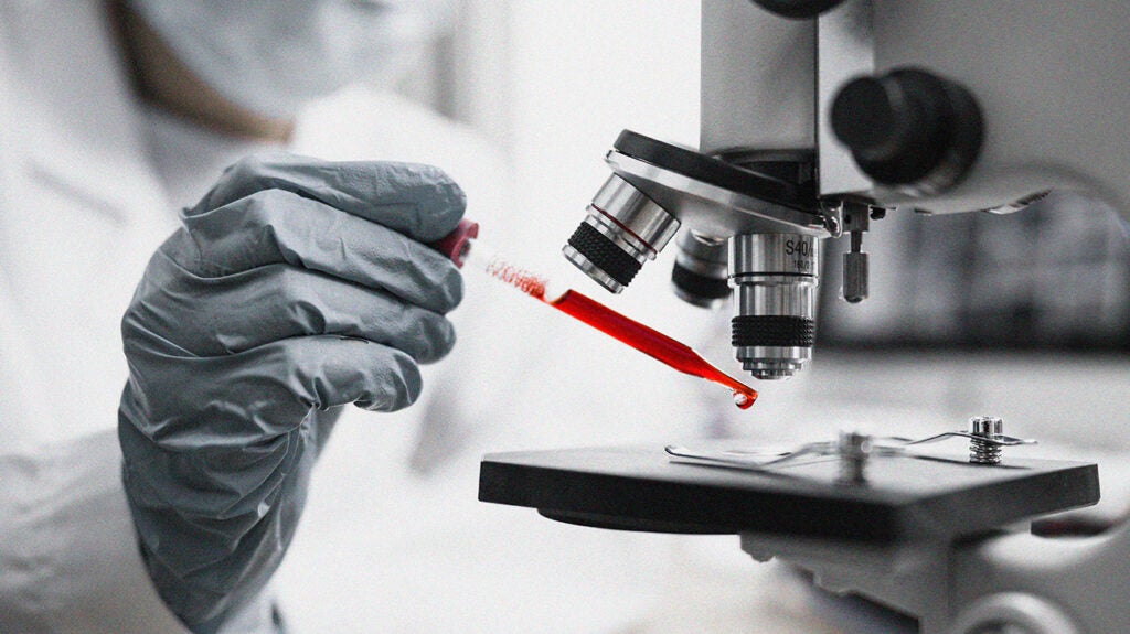 COVID19 5 blood proteins predict critical illness and death