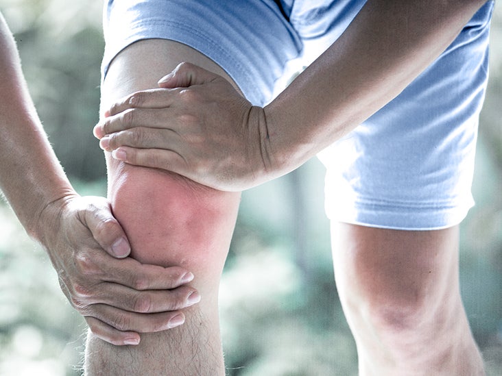 Gout in knee: Symptoms, treatment, and more