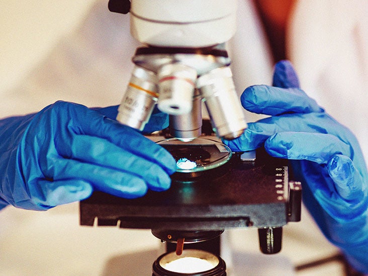 NiemannPick disease Causes, symptoms, treatment, and more