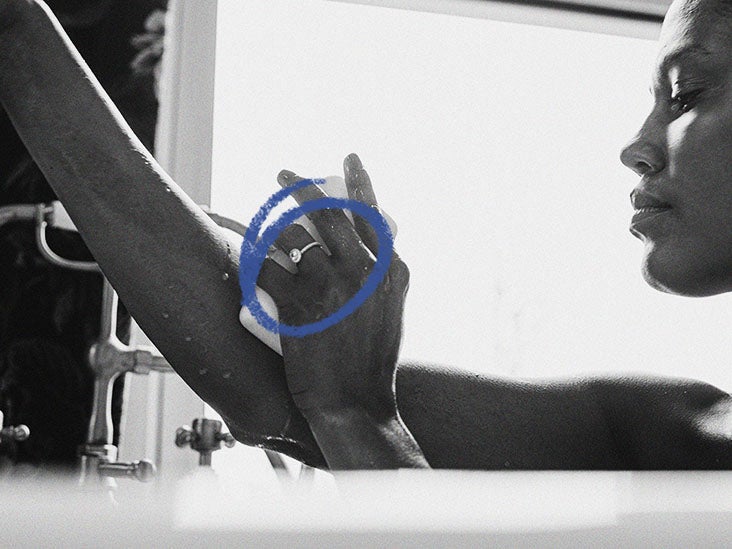 Weeping eczema Symptoms, causes, and treatment