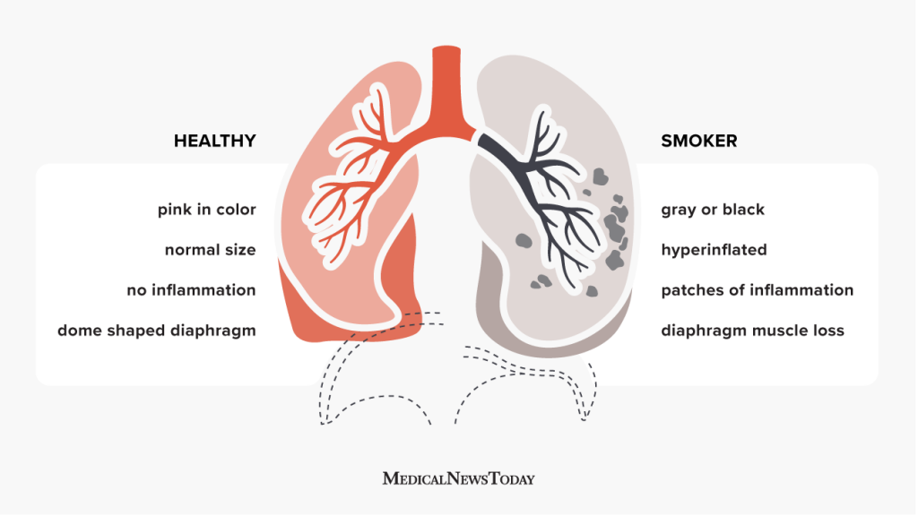 Demonstration of the presence of tar in cigarette smoke