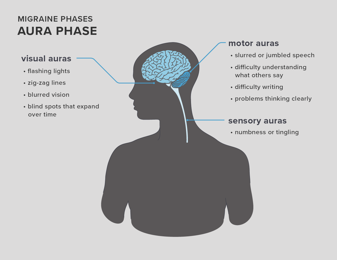 Ocular Migraine Blind Spot