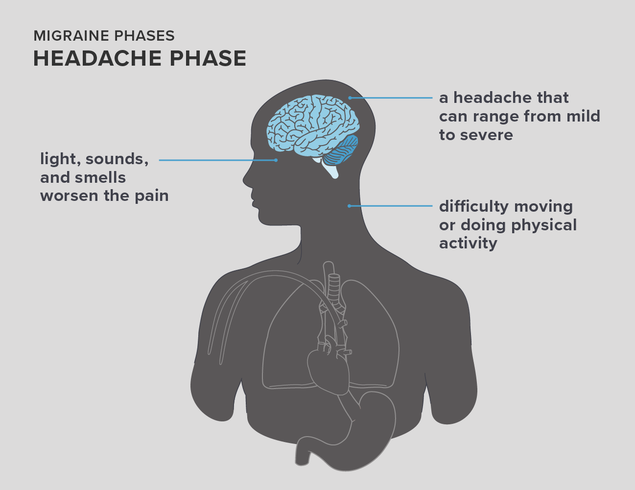 severe migraine headaches