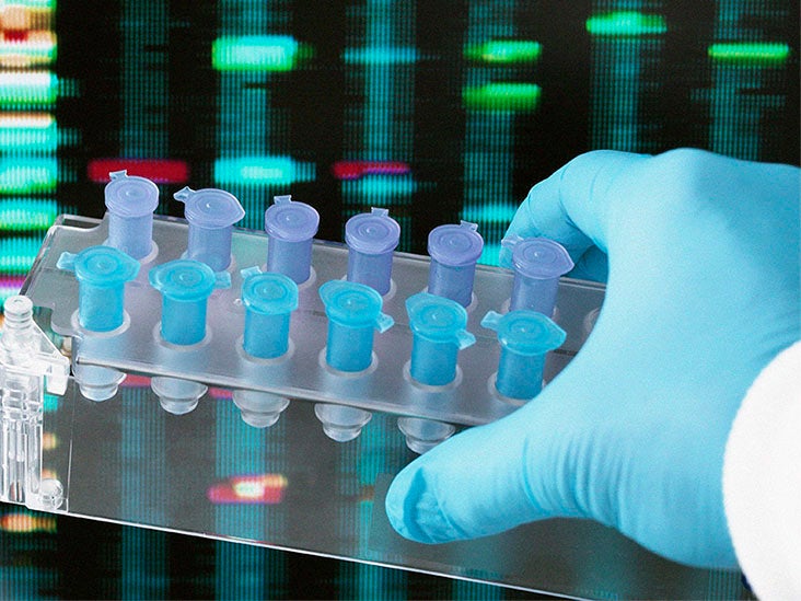 Is Crohn's disease Causes, testing, and more