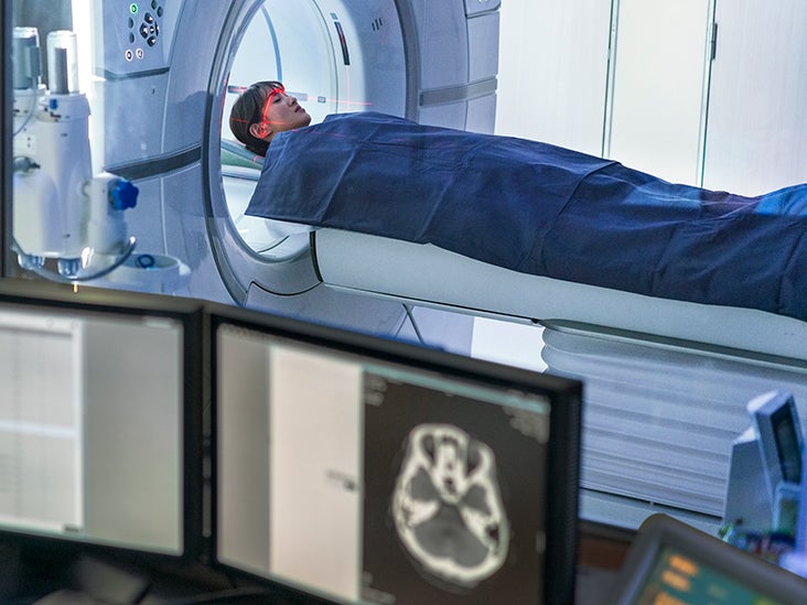 MS: AI helps discover 3 new subtypes