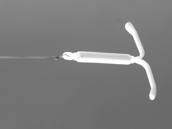 Mirena IUD side effects: Impact on mood, weight, and more