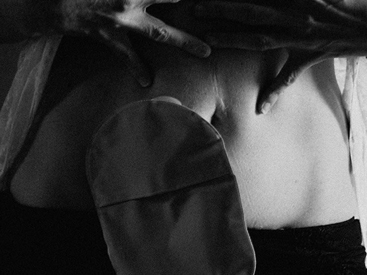 Ostomy Procedure, aftercare, duration, and more