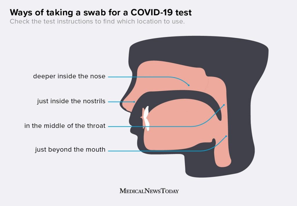 Coronavirus (COVID19) tests Methods, availability, and