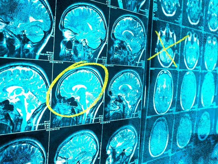 Genetic Mutations in Brain Tumors Could Turn Out Useful - Neuroscience News