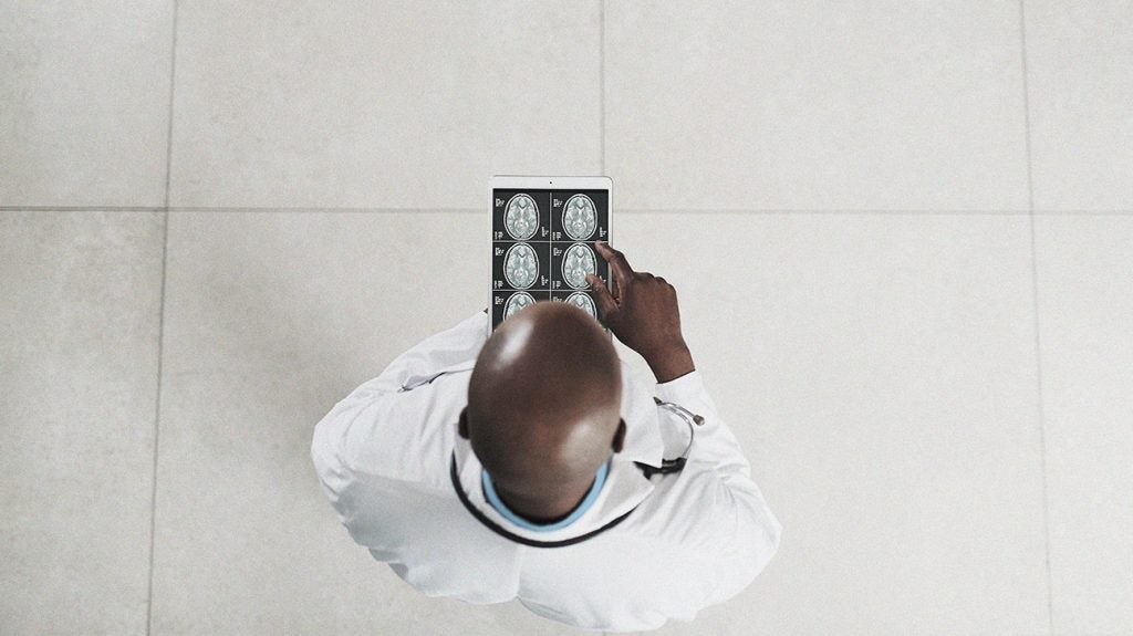 Late onset multiple sclerosis (MS) Symptoms and more